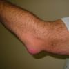 From Pain to Gain: Managing Elbow Pain in Weightlifting